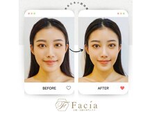 フェイシア 銀座店(Facia)の雰囲気（痛い!でも効く!結果重視のFacia式小顔矯正でお悩み改善☆[毛穴]）