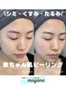 【内側から満たすパール肌】剥離なし♪赤ちゃん肌ピーリング¥17,600→