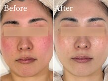 ボーテスキンクリニックの雰囲気（韓国水光肌がかなう圧倒的な肌管理サロン）