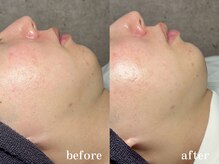 和歌山ララピール&韓国肌管理専門店/ララピール×LDM