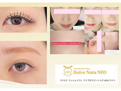 ドルチェナッツ ネオ 府内店(dolce nuts NEO)の写真