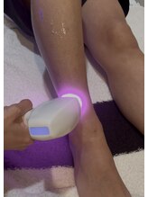 ストック(STOCK)/◇施術イメージ◇