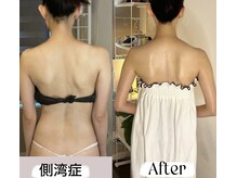 ソウ バイ ソウ(So by 蒼)/わずか３回劇的ビフォーアフター