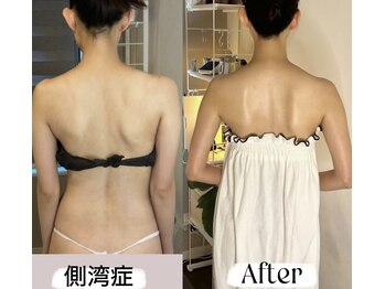 ソウ バイ ソウ(So by 蒼)/わずか3回劇的ビフォーアフター