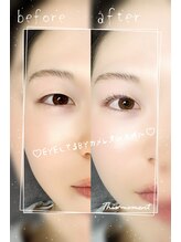 EYEシテル バイ カメレオンネイル/