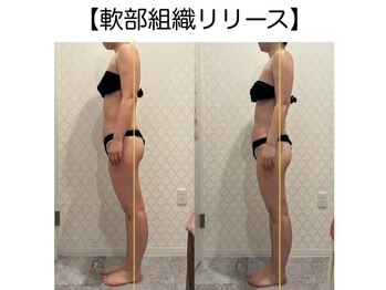 シャルム(CHARME)/新感覚筋膜リリース