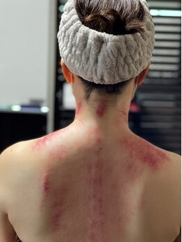 オウチ(OUCHI)/見えるデトックス・かっさ