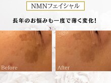 プリンセスフォーの雰囲気（一度でも驚く効果！回数を重ねるたびにお悩みから解消されます♪）