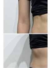 レナセール FUK 福岡店(RENACER FUK)/クビレ作り