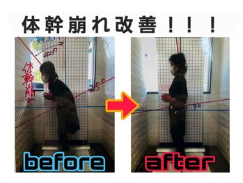 ほねくま接骨院 はりきゅう院 多賀城駅前院/姿勢写真
