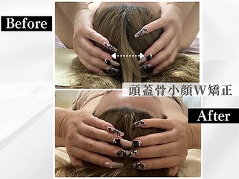 ポーベルポー(Peau Belle poe)/【不調も整う】頭蓋骨小顔W矯正