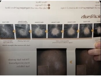 ルマエクレ(rmaecla)/【最新】韓国では当たり前のケア