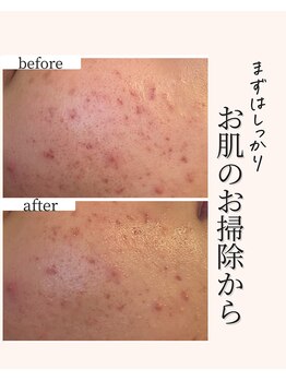 アネラ(Anela)/入れるものより落とすもの！