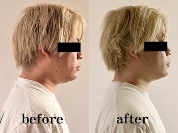 ベレミアム(Bellemium)/10分の奇跡★ネックケア