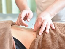 コウ 水戸(KOH)の雰囲気（鍼灸と整体、運動療法などを取り入れて様々な体の不調に対応◎）