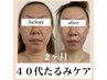 【目元・口元！お顔のたるみケア】極上オールハンド・エラスチンフェイシャル