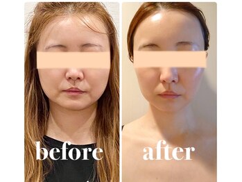 クリーム 京都店(Cream)/