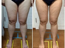 ビューティフルムーン(Beautiful Moon)/冷却1撃コース♪