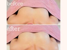 ワム(Wom)/左右差/歪み/バストケア/枚方