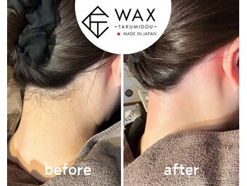 シエルエトワール 唐津店(Ciel Etoile)/匠道うなじワックス脱毛