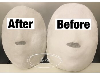 美極 トータルビューティー(美極 TOTAL BEAUTY)/恵比寿/小顔コルギ/エステ/