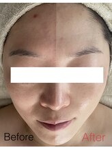 モーヴ(MAUVE)/次世代ハーブ陶肌トリートメント