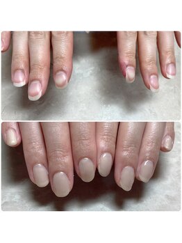 美爪育成ケア&ジェルネイル