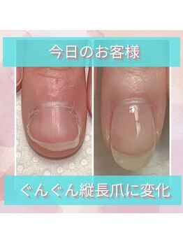 スマイルニコ(smile nico)/横広爪が縦長爪に