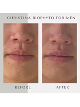 サロン ド ブラン アオヤマ(Salon de BLANC AOYAMA)/メンズフェイシャルに！