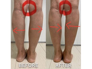 ココチ(KOKOCHI)/1回の施術でも変化あり