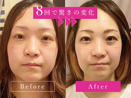 ネルジム 札幌店(NERU GYM)の写真