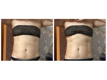 アンサー(ANSWER)/筋肉運動3万回してみませんか?