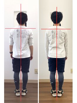 リライフ/Before/After