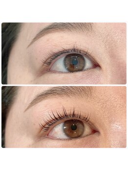 ルミナスアイ(Luminous Eye)/お得な回数券あり!