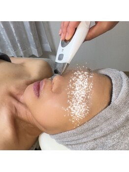 total beauty salon BL∞Mの写真/お肌のトラブルを根本からケア！シミ・しわ・たるみの改善＆予防に◎エイジングケアは当サロンにお任せ☆