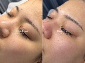 ハニ ラニ(Hani Lani)/お砂糖の力で、古い角質オフ。