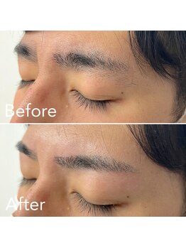 脱毛サロン メンズ 堂々/眉毛ワックス脱毛