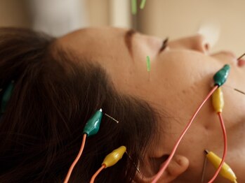 リュクス 恵比寿 代官山(LUXE)/施術風景【美容鍼/代官山/東京】