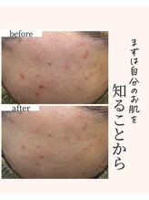 アネラ(Anela)/知ることから始めましょう！