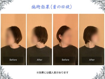 ボディ リセット アンド デザイン(Body Reset & Design)/【施術例】ビフォーアフター