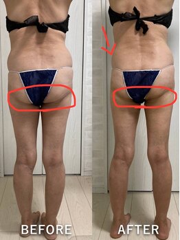 ココチ(KOKOCHI)/ボディラインが綺麗に!