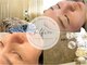 ベルフィーヌ(belfine)の写真