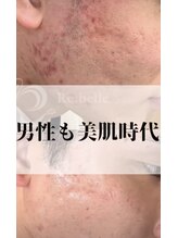 エヌ スタイル(N Style)/リベルハーブピーリング 