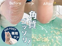 ディオフット(DIO FOOT)/足裏/かかとの角質除去