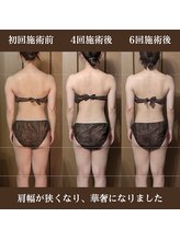 ルマ(Rumah)/【プレ花嫁】華奢な首肩に☆