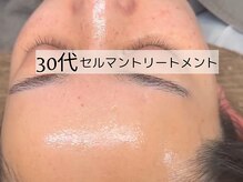 ウイ ネイルアンドビューティー(u'i nail&beauty)/５～６層の角質層を整えます♪