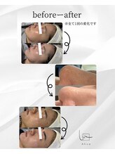 アリス(Alice)/お店について7