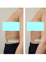 ラプレーヌ(La pleine)/