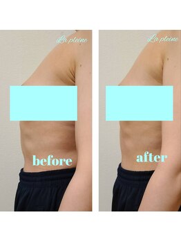 ラプレーヌ(La pleine)/