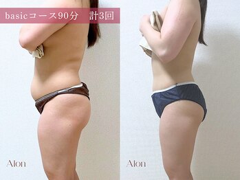 アイオン(Aion)/basicコース90分　計3回での変化